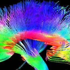 Cerebro y música: El efecto de la improvisación, la interpretación y los límites de la percepción